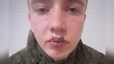 В Челябинской области свердловский солдат-срочник после ссоры с девушкой зашил себе рот