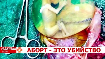 АБОРТ - ЭТО УБИЙСТВО! Ляшенко Ольга Викторовна, врач акушер-гинеколог, женская консультация №4, г Краснодар