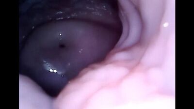 Камера внутри вагины / Camera inside Vagina Women