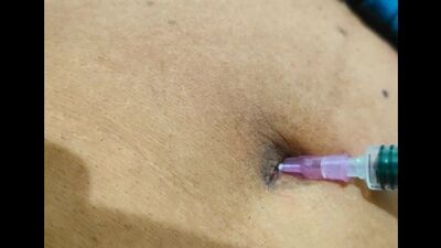 Injection In Marcella Menezes Belly Button